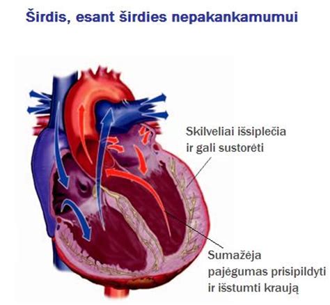 parazitų žmogaus širdies simptomai ir